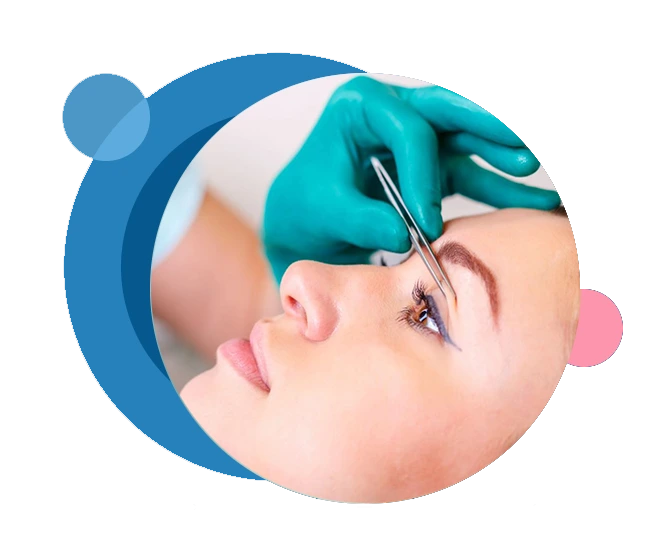 Esthetic Eyelid Surgery
