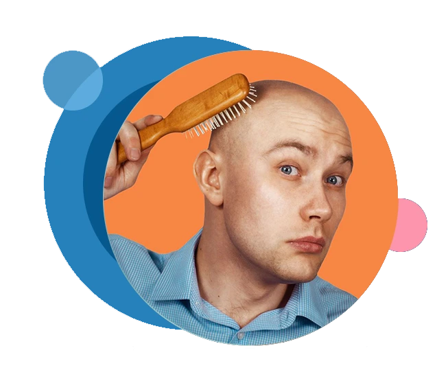 Hair Transplantation