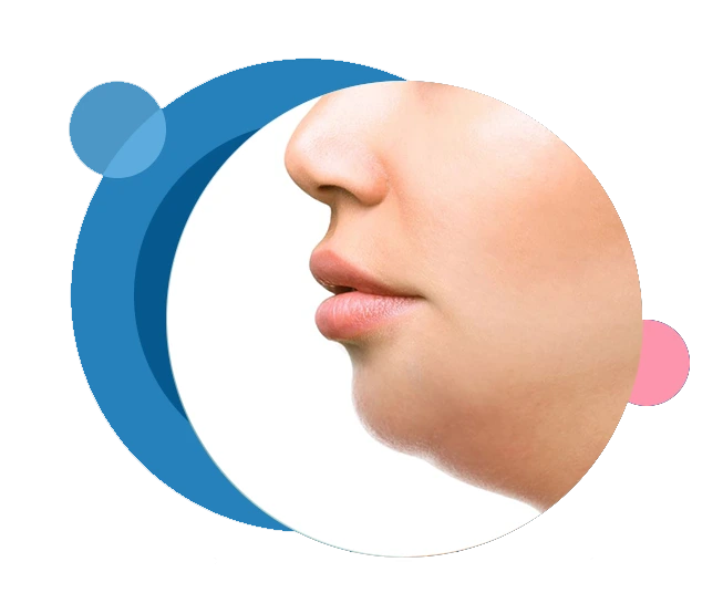 Double Chin Correction